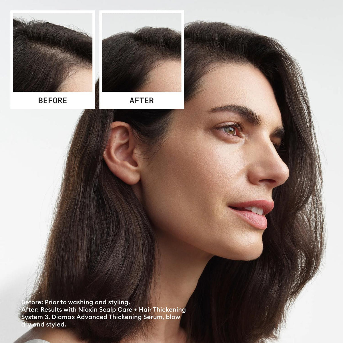 Nioxin Scalp + Hair Thickening System 3 Mini Set – Ansicht 3