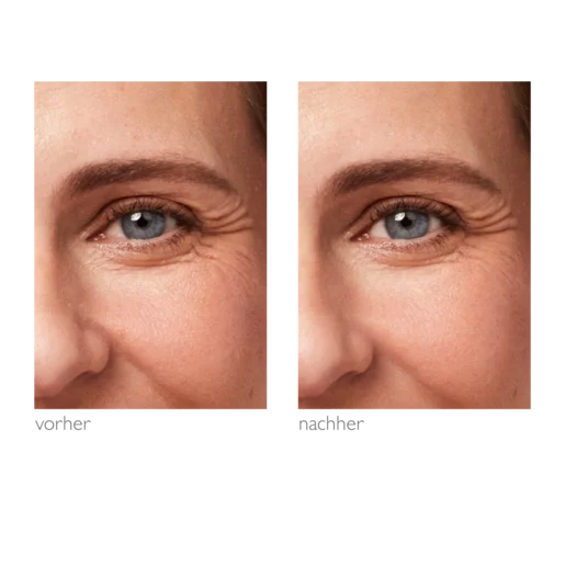 alcina-rose-effekt-augencreme-15-ml-252043-f35392